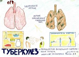 Украинцы не знают и не хотят знать правду о туберкулезе