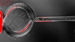 Из клона эмбриона человека впервые получены стволовые клетки