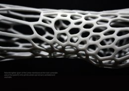 Новозеландец разработал и напечатал на 3D принтере экзоскелетный гипс (ФОТО)