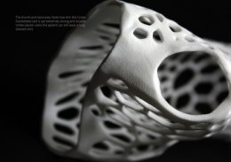 Новозеландец разработал и напечатал на 3D принтере экзоскелетный гипс (ФОТО)