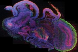 Ученые впервые вырастили миниатюрный человеческий мозг (ВИДЕО)