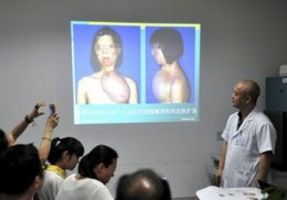 Китайские хирурги пересадили лицо 17-летней девушке