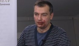 Пятеро "титушек" напали на журналиста (ВИДЕО)