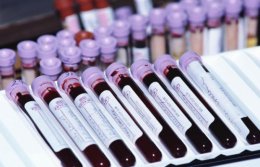 Искусственная кровь из стволовых клеток заменит донорскую