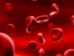 Причины возникновения железодефицитной анемии