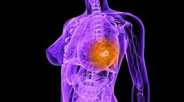 Лекарство от рака груди эффективно только по ночам