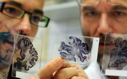 Ученые создали лекарство, способное ликвидировать последствия болезни Альцгеймера