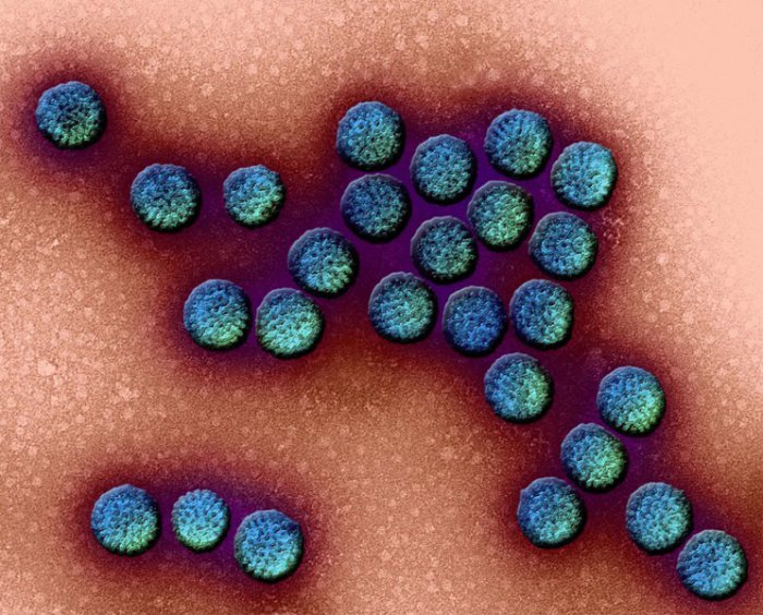Вирусы, несущие не меньшую опасность, чем Эбола (ФОТО)