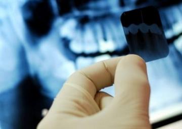 Рентген зубов может привести к раку мозга