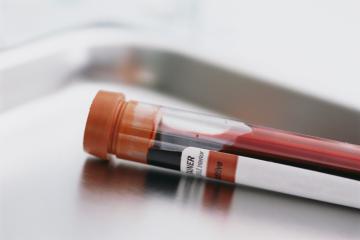 Американские ученые придумали новый инструмент анализа крови