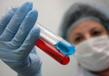Исследователи нашли средство защиты от ВИЧ