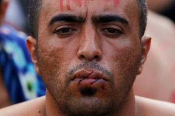 Мигранты зашивают себе рты в знак протеста