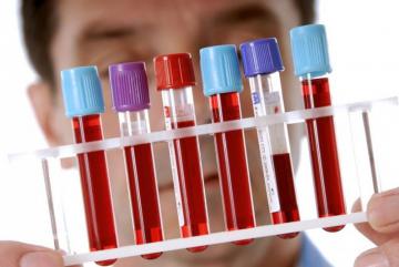 Что нужно знать об общем анализе крови (ФОТО)