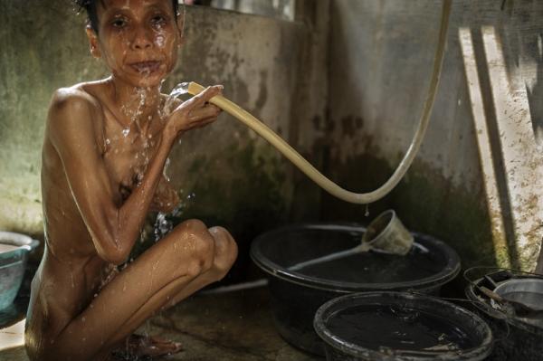 Ужасающие условия индонезийских лечебниц для душевнобольных (ФОТО)