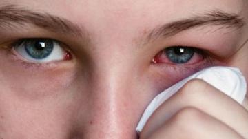 Клиническая картина заболеваний глаз зависит от этиологии
