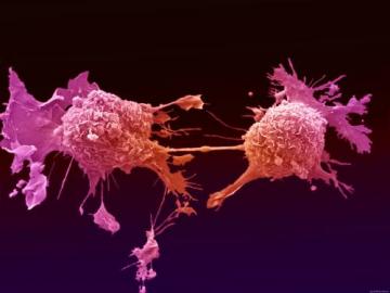 Ученые назвали основные причины возникновения рака