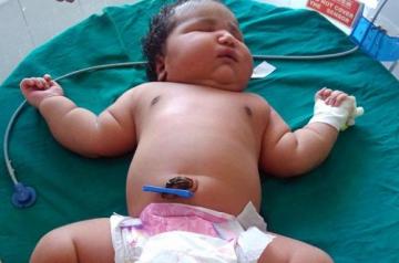 В Индии родилась самая тяжелая девочка