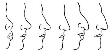 Ученые обнаружили гены, которые определяют внешний вид носа