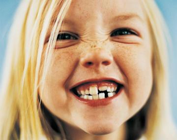 Неровные зубы способны ухудшить осанку и равновесие