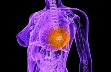 Невероятное открытие: Ученые обнаружили, что провоцирует рак груди