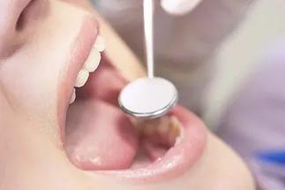 Медики обнаружили пользу клюквы для зубов