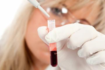 Группа крови влияет на потенцию мужчины, - ученые