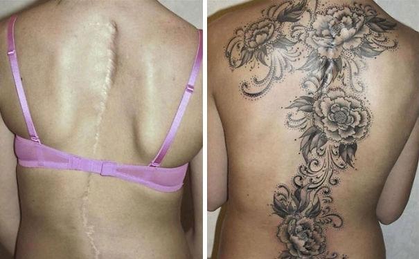 20 прекрасных татуировок, превращающих шрамы в произведения искусства (ФОТО)