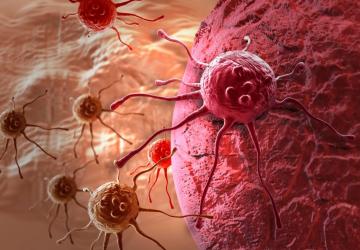 Ученые отследили развитие раковой опухоли