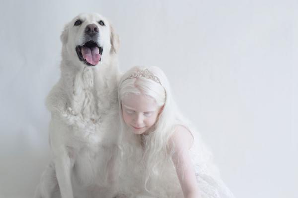 «Фарфоровая красота»: фотопроект о неземной красоте людей-альбиносов (ФОТО)