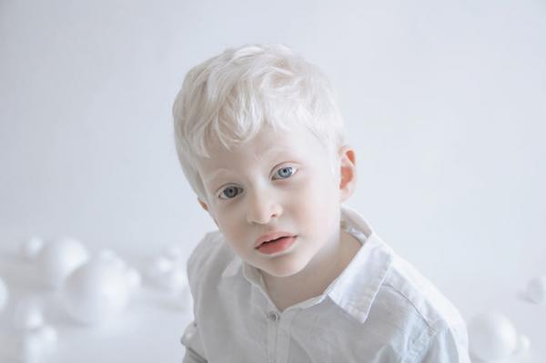 «Фарфоровая красота»: фотопроект о неземной красоте людей-альбиносов (ФОТО)