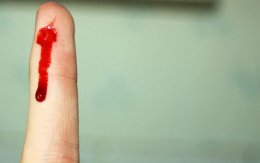 Человеские раны затягиваются быстрее чем у животных