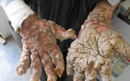 9 самых несчастных людей на земле