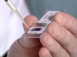 Российские ученые разрабатывают нанобиочип от многих болезней