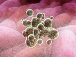 Ученым стало известно, как выглядит смерть пораженных болезнью клеток