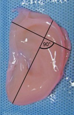 В лаборатории вырастили настоящее человеческое ухо (ФОТО)