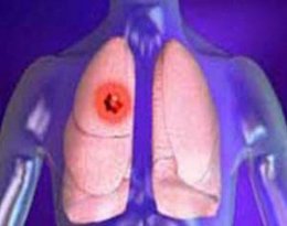 Отрицательные эмоции снижают иммунитет