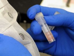 Из научно-исследовательского центра США исчезла пробирка с очень опасным вирусом