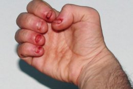 Десять самых необычных мутаций, встречающихся у людей (ФОТО)