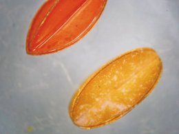 Микроскопические роботы сохранят здоровье глаз