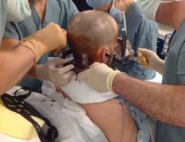 Пациент сыграл на гитаре во время операции на мозге (ФОТО+ВИДЕО)