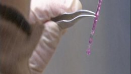 Ученые успешно имплантировали искусственный кровеносный сосуд