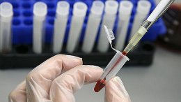 Американским медикам удалось вылечить двоих пациентов с ВИЧ