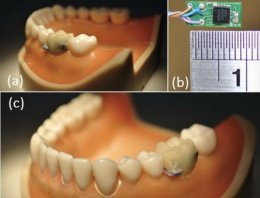 О здоровье человека расскажут встроенные в зубы чипы (ФОТО)