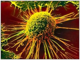 Ученые обнаружили клетки, которые создают условия для рака