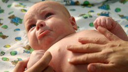 Ученые обнаружили связь между коликами и мигренью