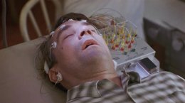 Исторический поворот в борьбе с болезнями Альцгеймера и Паркинсона