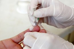 Российские ученые разработали новый способ забора крови для анализов