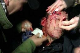 В Интернете появилось видео избиения Луценко (ВИДЕО)