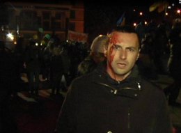 Европа готова принять пострадавших "майдановцев" в своих больницах (ВИДЕО)