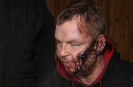 МВД возбудило уголовное дело по факту похищения Булатова (ВИДЕО)